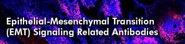 EMT Related Antibodies