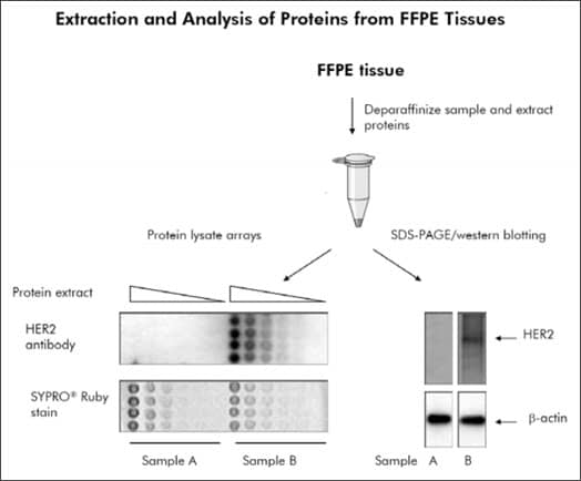 FFPE Tissue Extraction Kit – Isolate Protein from FFPE Sections