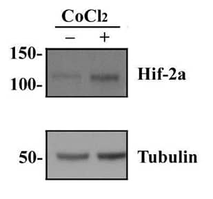 For hypoxia studies a useful control consists of hypoxic and normoxic treated cells in culture. For example, HepG2 cells may be incubated under normoxic or hypoxic conditions, cell lysates prepared and analyzed for HIF-1a expression by Western blot with HIF-1a antibody.