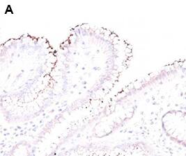 Immunocytochemical detection of adenovirus infected cells with anti-adenovirus mouse monoclonal antibody.