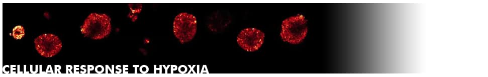 Hypoxia Signaling Novus Biologicals