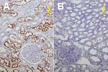 ACE-2 expression was analyzed in immersion fixed paraffin-embedded tissue sections of human kidney and counterstained with hematoxylin (blue). 