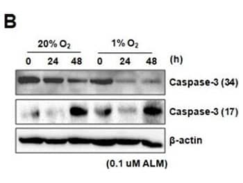 Western blot analysis for detection of Caspase-3 PC3 cells treated with ALM under normoxia and hypoxia and probed with anti-Caspase-3 antibody.