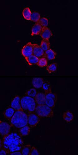 Immunocytochemical analysis of THP-1 human acute monocytic leukemia cells either untreated (bottom) or treated with PMA and LPS (top) and probed with anti-NLRP3/NALP3 antibody followed by NorthernLights 557-conjugated secondary antibody (red).