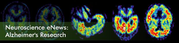 Neuroscience eNew: Alzheimer's Research
