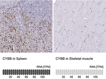 NOX2 expression in human spleen and skeletal muscle IHC, RNA-seq