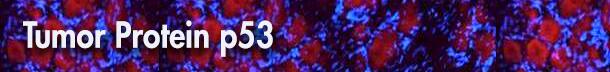 Tumor protein p53