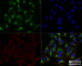 p62/SQSTM1 Antibody