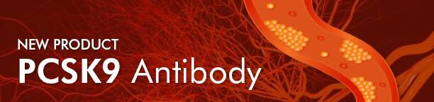 New Product: PCSK9 Antibody