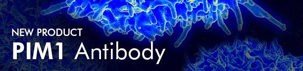 New Product: PIM1 Antibody