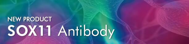 New Product: SOX11 Antibody