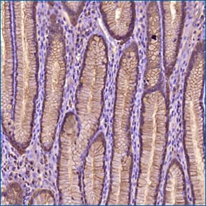 Novus STARD10 Antibody New rabbit polyclonal STARD10 primary antibody from Novus Biologicals.