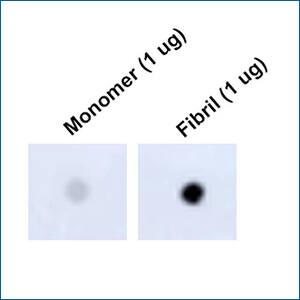 Novus Tau Antibody (1D5) – Pre-formed fibrils New mouse monoclonal Tau (1D5) primary antibody (pre-formed fibrils) from Novus Biologicals.