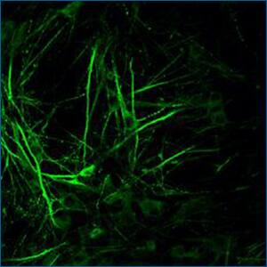 Novus Tau Antibody (3D4) – Pre-formed Fibrils New mouse monoclonal Tau (4D4) primary antibody (pre-formed fibrils) from Novus Biologicals.