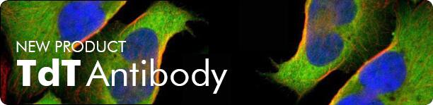 New Product TdT Antibody