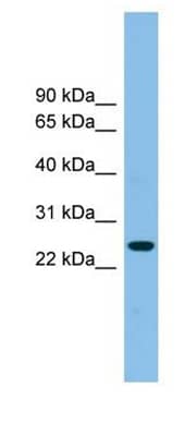 Tetraspanin-4 was detected in Jurkat cell lysates by Western blot using rabbit polyclonal tspan4 antibody.