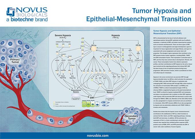 Tumor Hypoxia and EMT Poster