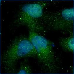 VEGFR2/KDR/Flk-1 Antibody staining of HepG2 cells and detected with DyLight 488 (green), ICC/IF. HepG2 cells incubated with rabbit polyclonal VEGFR2/KDR/Flk-1 Antibody, detected with anti-rabbit DyLight 488 (green), and nuclei counterstained with DAPI (blue).