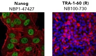 R&D Systems antibody for CCR6 was used to detect the GPCR on mouse splenocytes with flow cytometry.