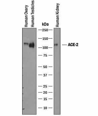 ACE-2 expression was analyzed in tissue lysates from human ovary, testis, and kidney, Western blot analysis reveals a single band around 120kDa.