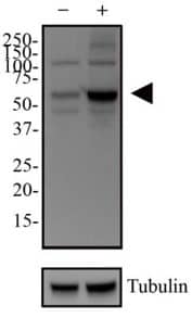 Expression of p62/SQSTM1 and LC3B, autophagy inhibition with chloroquine Western blot