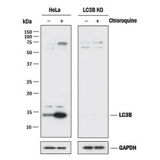 Expression of p62/SQSTM1 and LC3B, autophagy inhibition with chloroquine Western blot