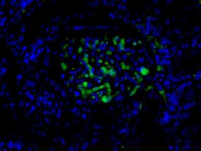 Apolipoprotein B/ApoB Antibody (7B8) - BSA Free (NBP2-23519): Novus ...