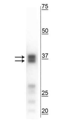 Arginase 1/ARG1/liver Arginase Antibody (NBP3-11945): Novus Biologicals