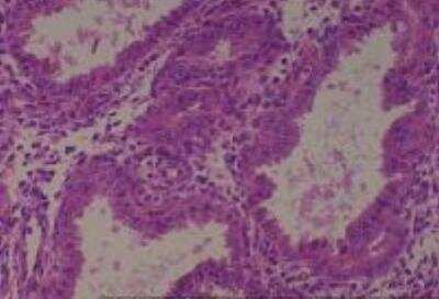 Human Multi Tissue MicroArray (Normal Adjacent) (NBP2-30217): Novus ...