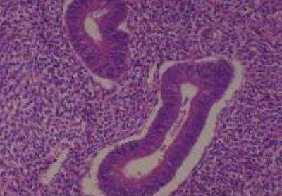 Human Multi Tissue MicroArray (Normal Adjacent) (NBP2-30217): Novus ...