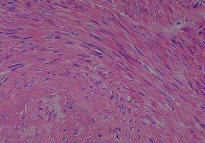 Human Multi Tissue MicroArray (Normal Adjacent) (NBP2-30217): Novus ...