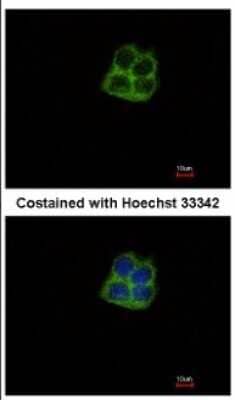 mtRNA polymerase Antibodies: Novus Biologicals