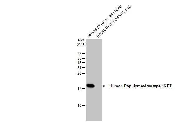 Hpv16 E7 Antibody Hl1821 Azide And Bsa Free Nbp3 25511 Novus