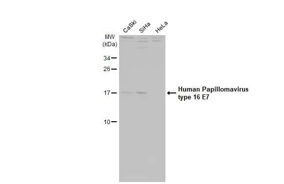 Hpv16 E7 Antibody Hl1821 Azide And Bsa Free Nbp3 25511 Novus