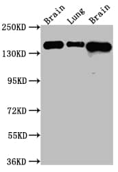 FGFR2 Antibody (2E9) (NBP3-26583): Novus Biologicals