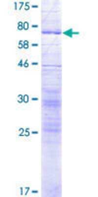 Recombinant Human SLC17A4 GST (N-Term) Protein (H00010050-P01): Novus ...