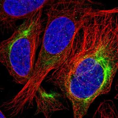 Als2 Antibody (NBP2-14284): Novus Biologicals