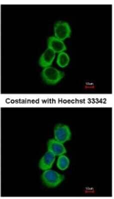 BHMT Antibody (NBP1-32443): Novus Biologicals