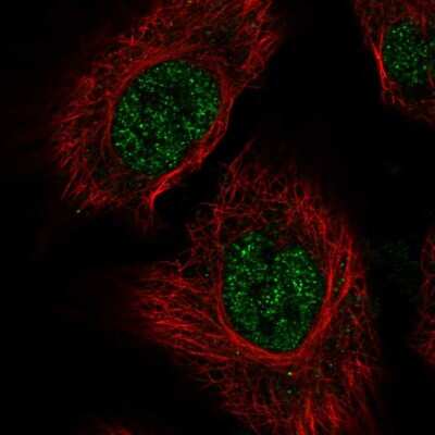 RSRP1 Antibody (NBP2-55902): Novus Biologicals