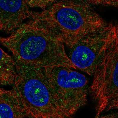 CACNG6 Antibody (NBP2-56816): Novus Biologicals