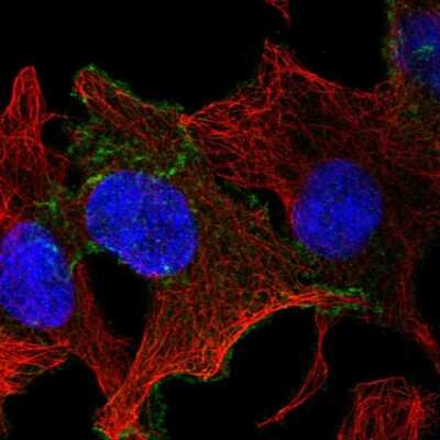 CELSR1 Antibody (NBP2-55658): Novus Biologicals