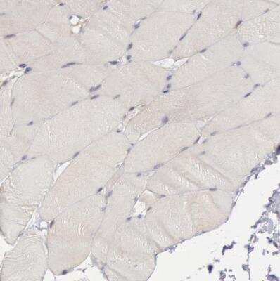 COX-2 Antibodies: Novus Biologicals