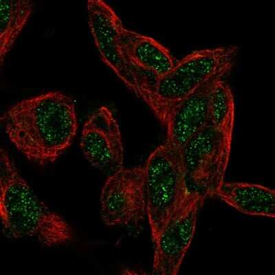 CTDSP1 Antibody (NBP2-57578): Novus Biologicals