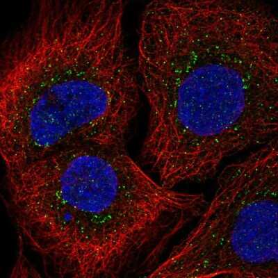 Common gamma Chain/IL-2 R gamma Antibody (NBP2-56084): Novus Biologicals