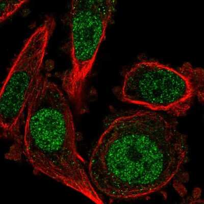 DUSP4 Antibody (NBP2-56808): Novus Biologicals