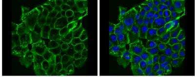 E Cadherin Antibody Nbp2 16258 Novus Biologicals