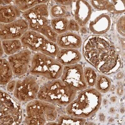 FREM2 Antibodies Novus Biologicals
