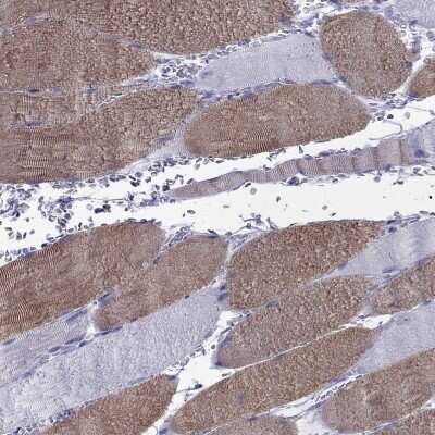 Fast skeletal myosin light chain 2 Antibody (NBP2-62625): Novus Biologicals