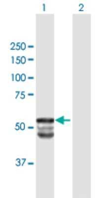 GAL3ST1 Antibody (H00009514-B01P): Novus Biologicals