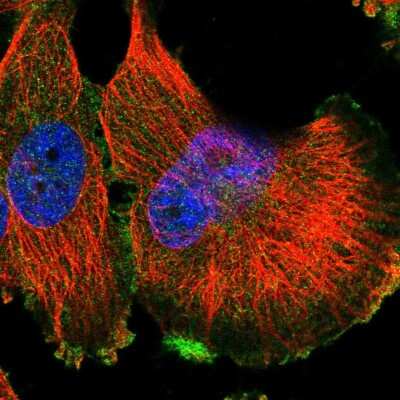 HGFR/c-MET Antibody (NBP2-55719): Novus Biologicals